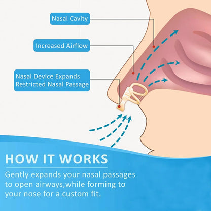 Anti Snore Nasal Dilator - Improve Sleeping
