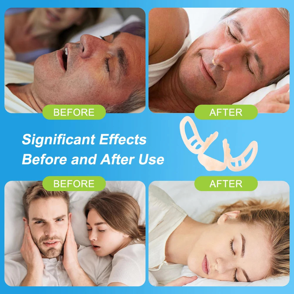 Anti Snore Nasal Dilator - Improve Sleeping